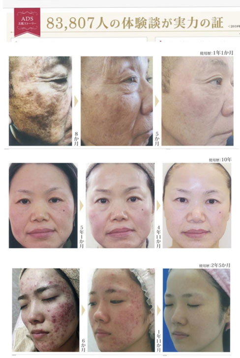 8万人以上の実績